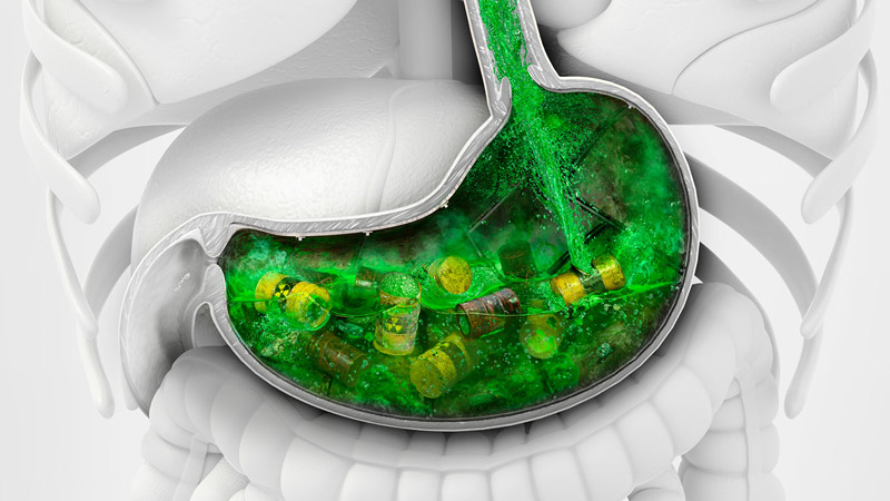 Toxic Stomach Indigestion